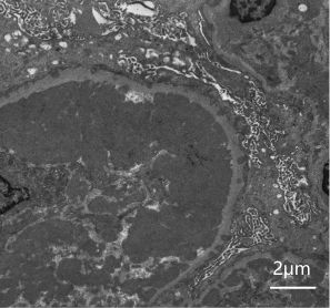 sem image analysis Renal Pathology Section